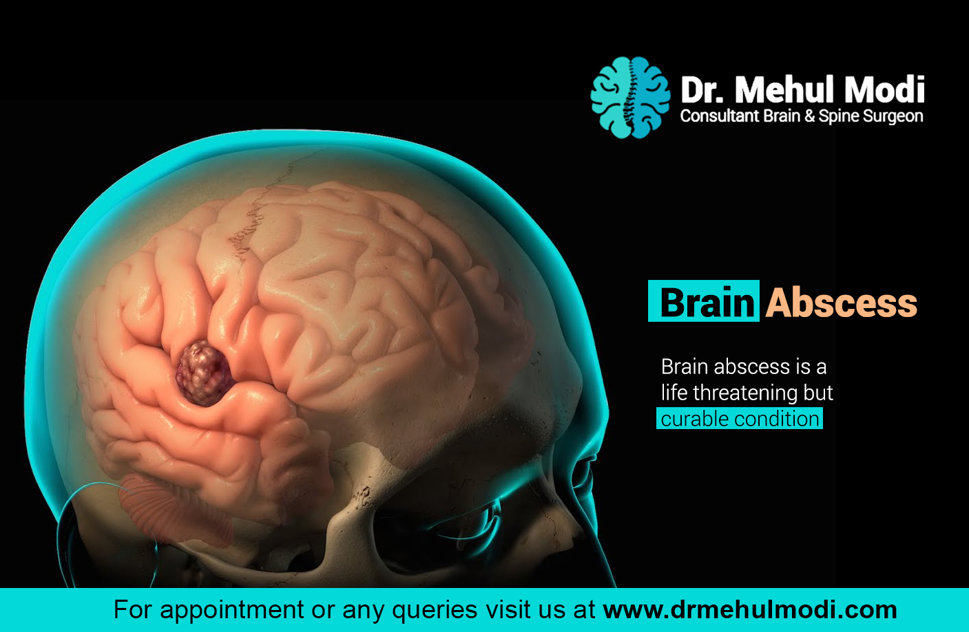 Brain abscess